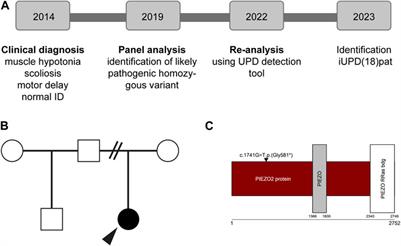 Case report: Complete paternal isodisomy on chromosome 18 induces methylation changes in PARD6G-AS1 promotor in a case with arthrogryposis